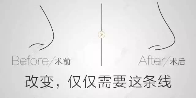 美莱·SMART立体美鼻