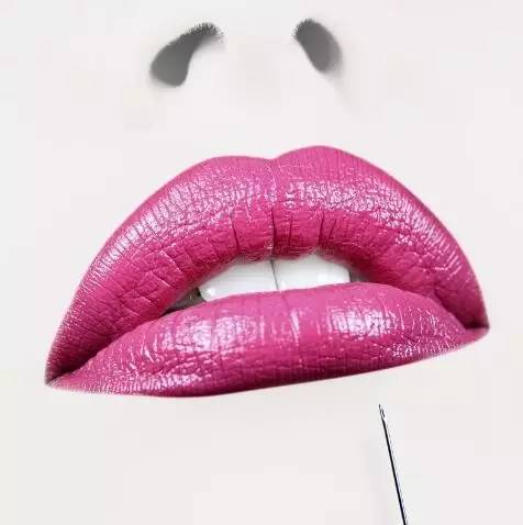 注射玻尿酸丰唇