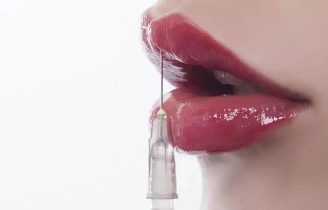 注射玻尿酸丰唇