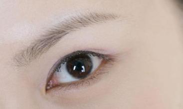 上海美莱开眼角