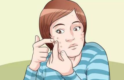 上海美莱祛痘好不好