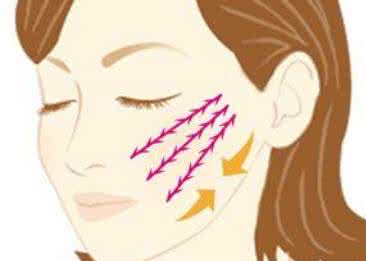 上海美莱注射去除鱼尾纹