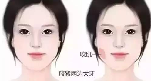 正规一针多少钱