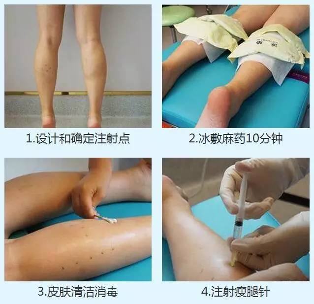 上海美莱瘦腿针的就诊流程