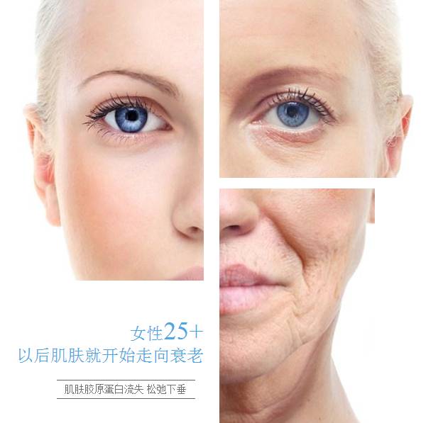 <a href='/' target='_blank'><u>上海美莱</u></a>蛋白线,面部提升年轻再“线”