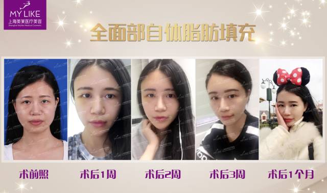 上海美莱雕塑后的蜕变