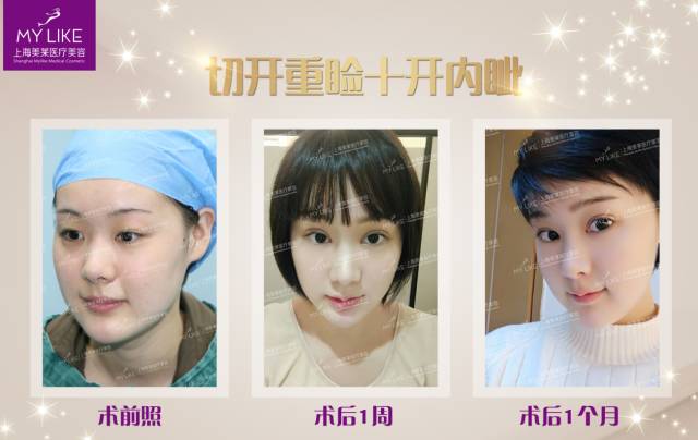 上海美莱雕塑后的蜕变