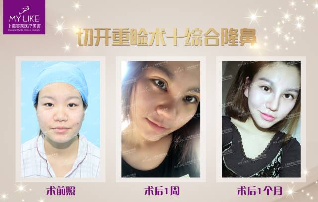 上海美莱雕塑后的蜕变