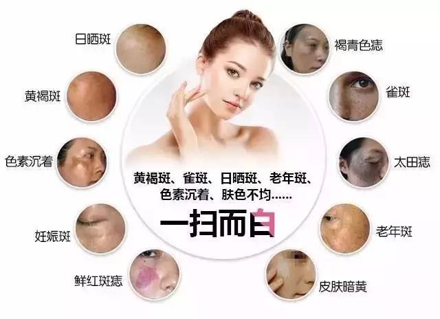 上海美莱蜂巢皮秒祛斑