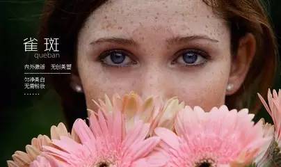 上海美莱激光去雀斑