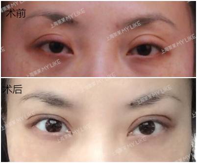 杜医生眼部修复