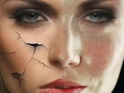 <a href='/' target='_blank'><u>上海美莱</u></a>水光针