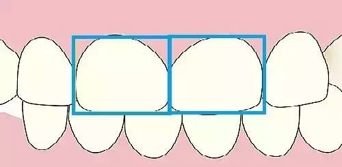 两上中切牙对称