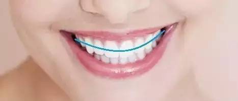 上海美莱牙齿矫正