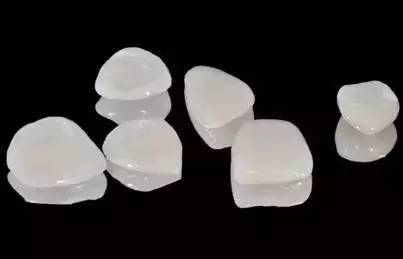 上海美莱牙贴面