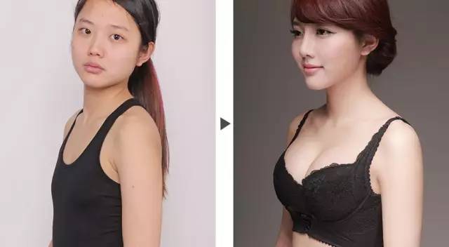 欧阳天祥整形案例