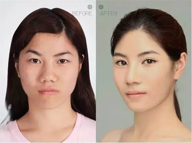 欧阳天祥整形案例