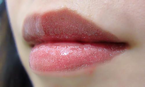 注射丰唇多少钱