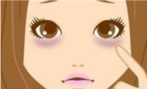 上海去眼袋手术多长时间