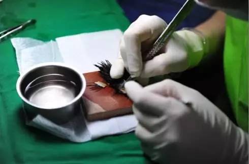 专业的毛囊分离