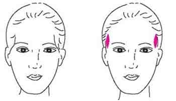 丰太阳穴多少钱