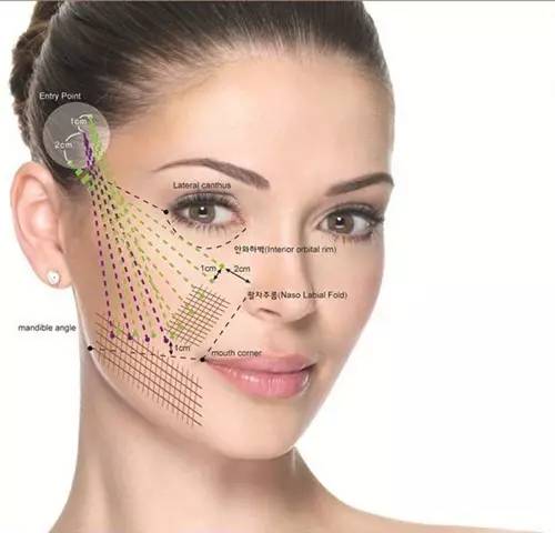 <a href='/' target='_blank'><u>上海美莱</u></a>线雕