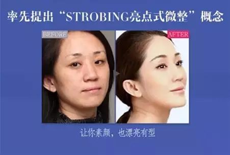 Strobing亮点式微整 