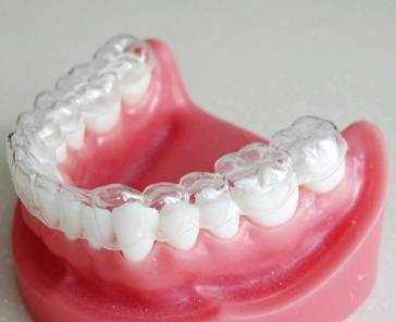 隐形牙齿矫正