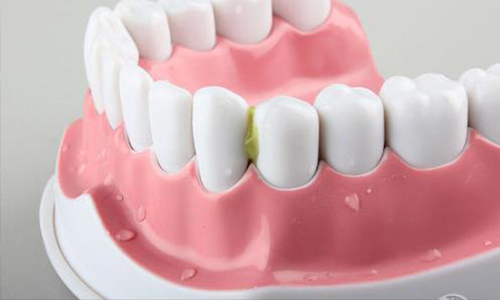 <a href='/' target='_blank'><u>上海美莱</u></a>牙齿修复