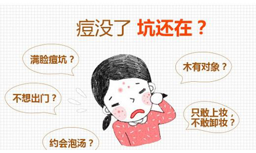 像束激光祛痘坑自然不好