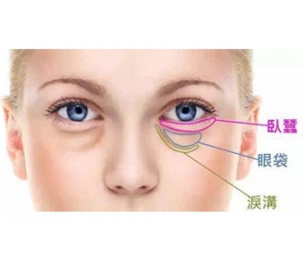 眼袋手术上海哪个医院好