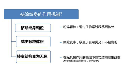 上海吗皮秒洗纹身