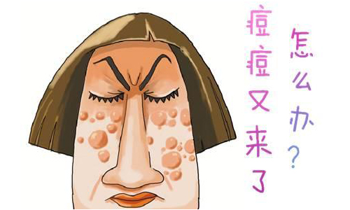 上海美莱激光祛痘