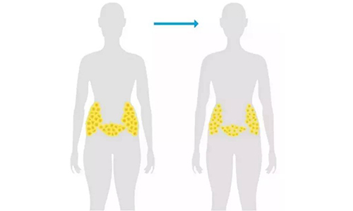 减肥瘦身有效的方法