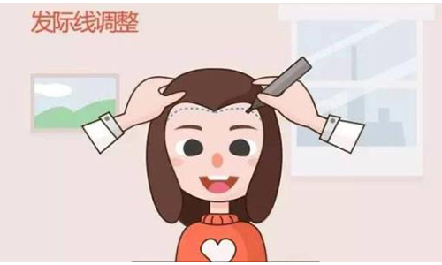 上海植发际线哪里好