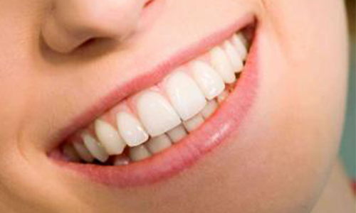 牙齿矫正到底要不要拔牙