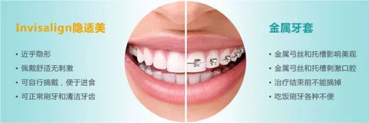 美莱隐适美矫正