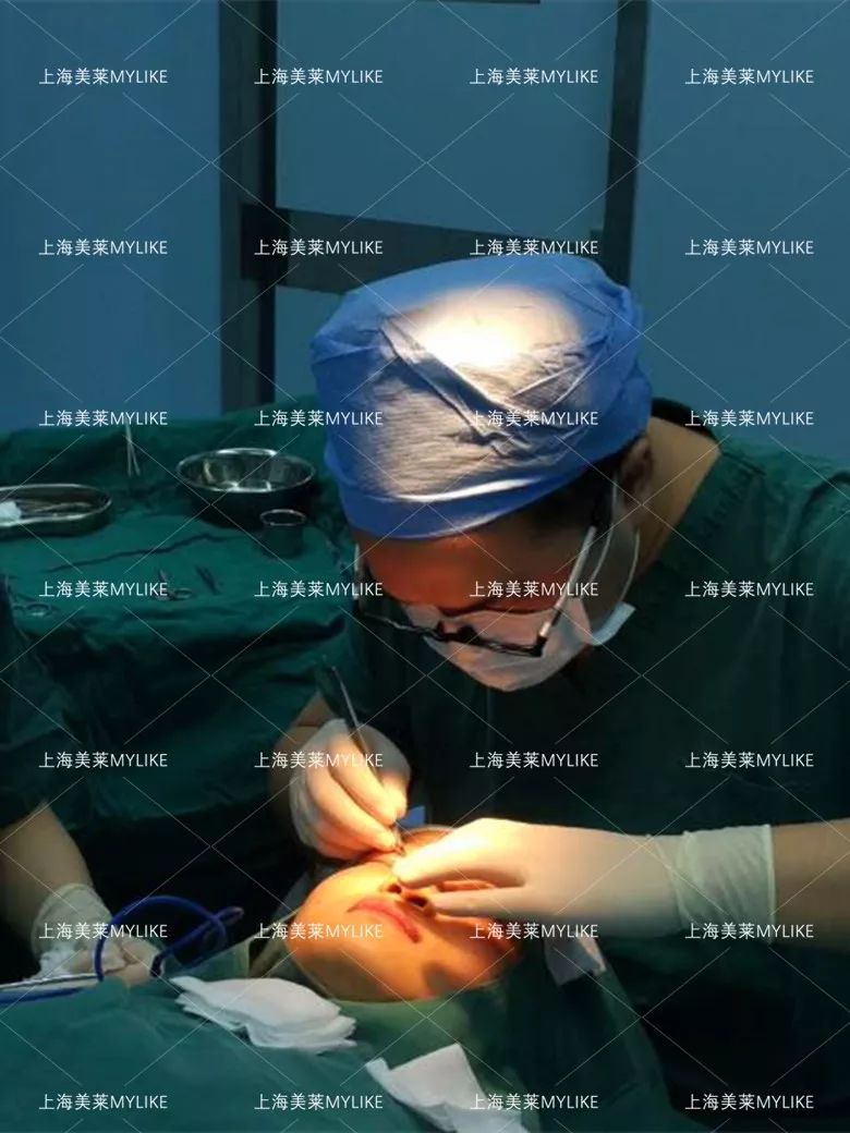 何祥龙做双眼皮手术过程