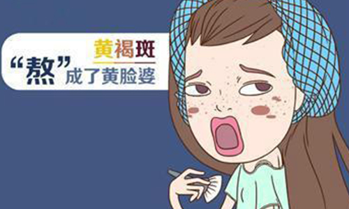 美莱皮秒去黄褐斑