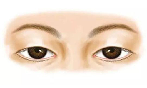 上海做上睑下垂修复手术很好的医生是谁