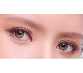 都适合什么人?打瘦脸可以维持多久