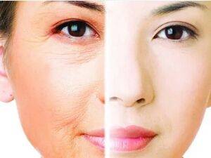 上海美莱植发案例