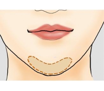 打没效果是什么原因