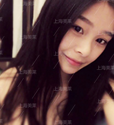 上海美莱丰胸整形