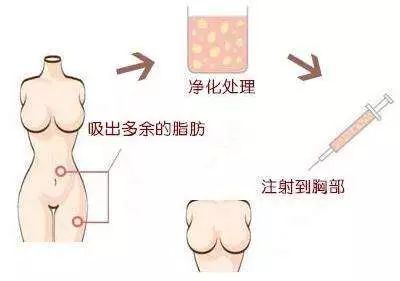 牙齿发酸是需要看牙医了