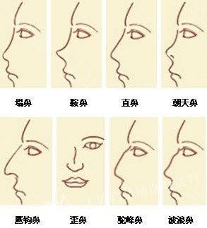 自体脂肪面部填充