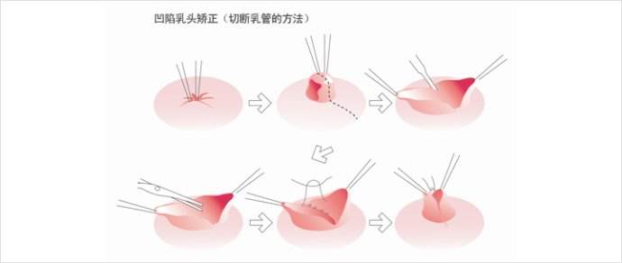 <a href='/' target='_blank'><u>上海美莱</u></a>丰胸整形