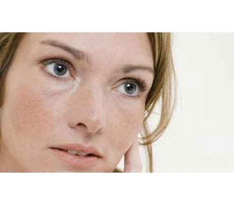 隆鼻术后鼻子一直红肿,是不是做坏了