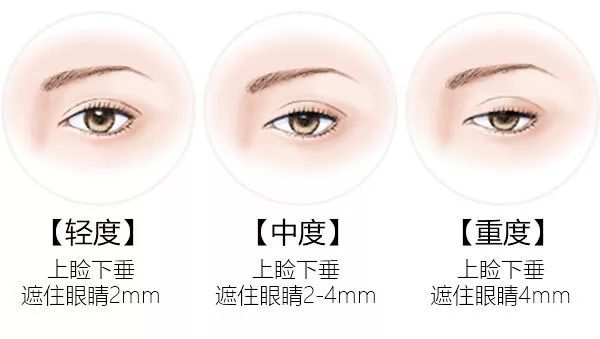 上海美莱真人案例