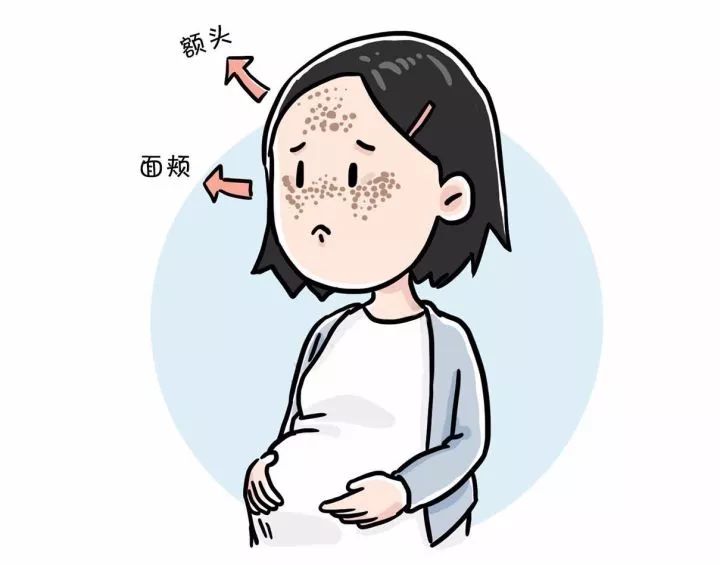 玻尿酸除皱多少钱